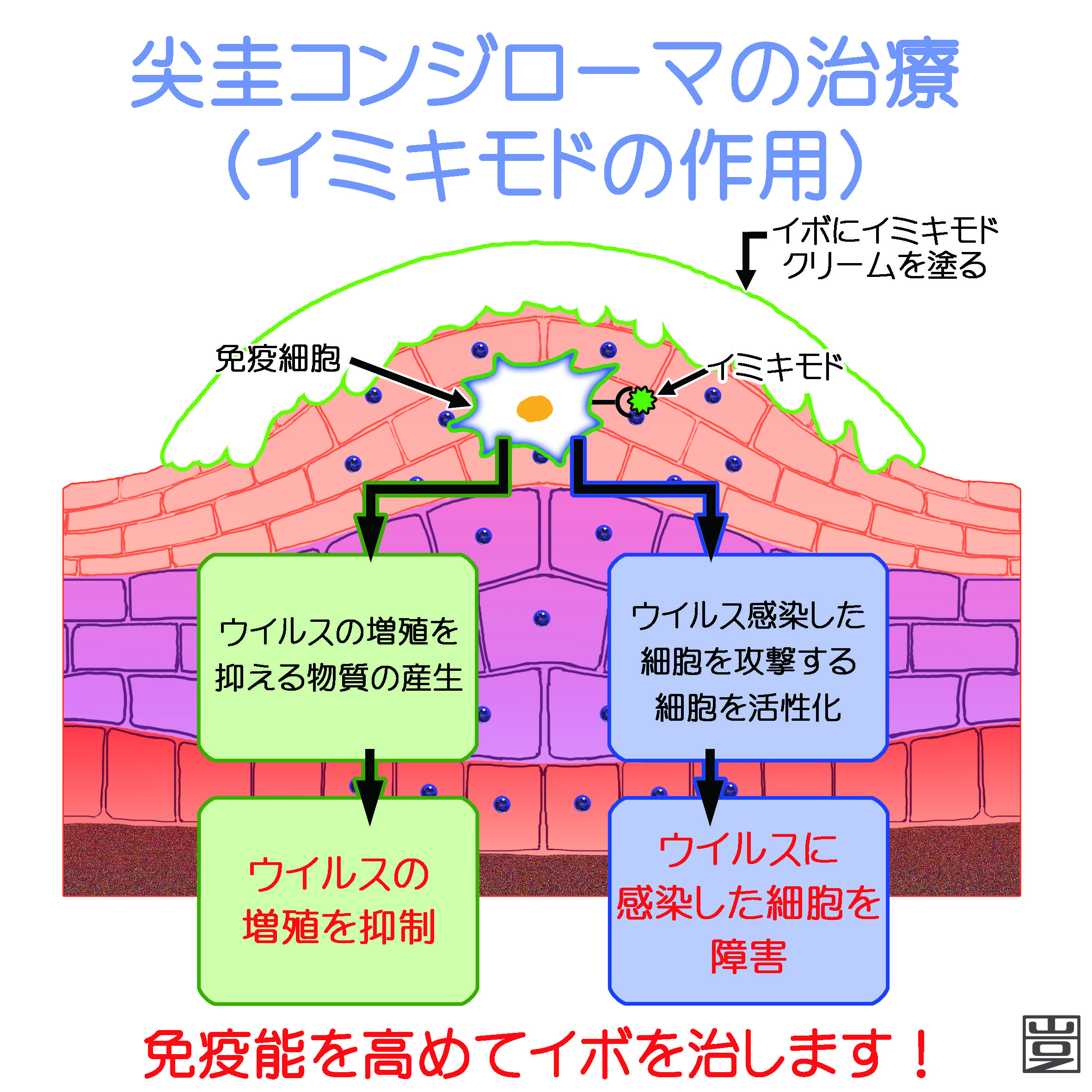 コンジローマ 初期 画像