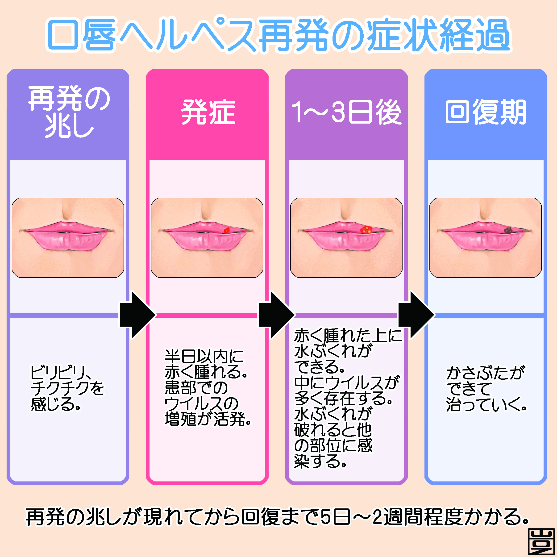 ヘルペス 口唇 口唇ヘルペスとは？｜再発のしくみ｜口唇ヘルペスの再発治療薬：アクチビア軟膏