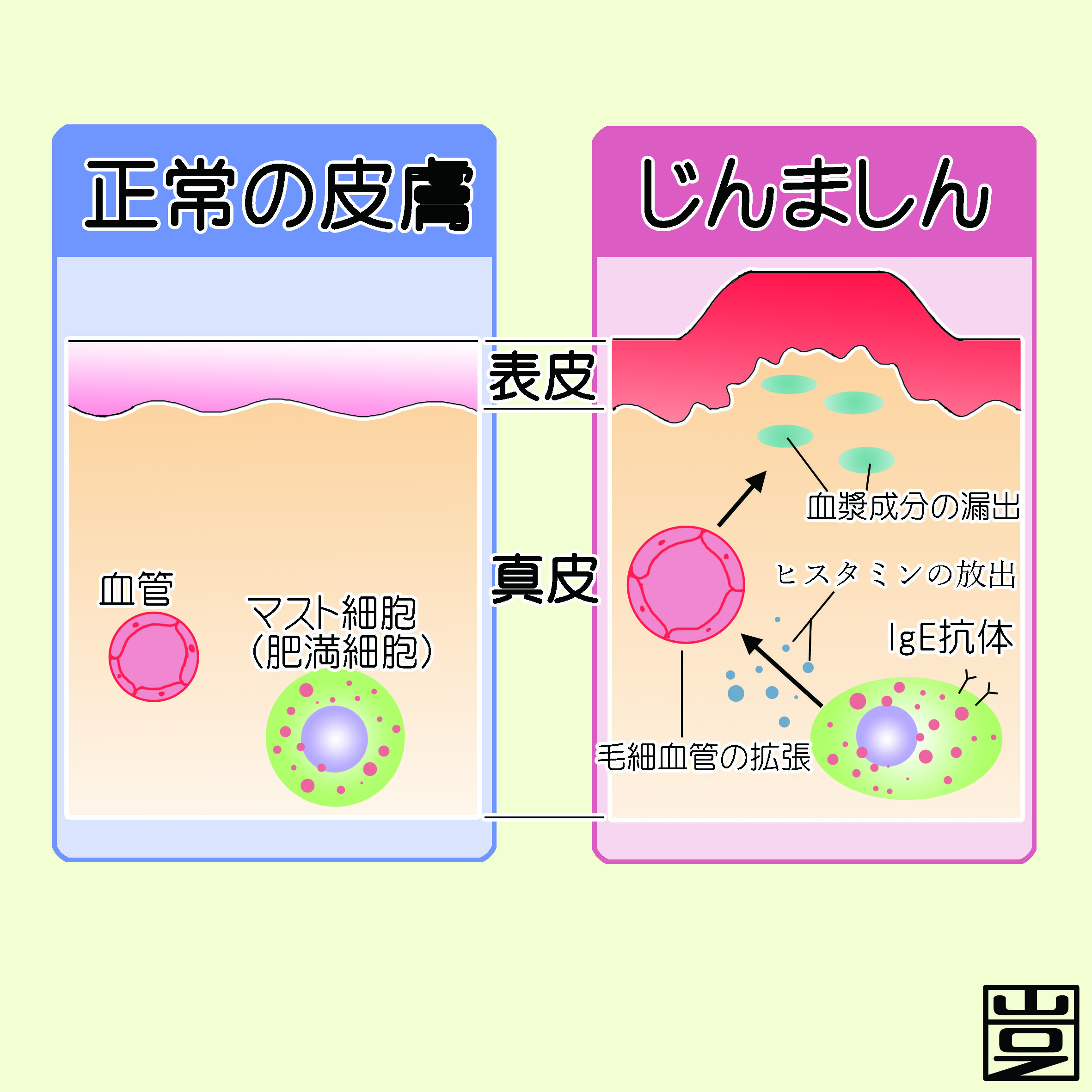 正常の皮膚・じんましんのイラスト