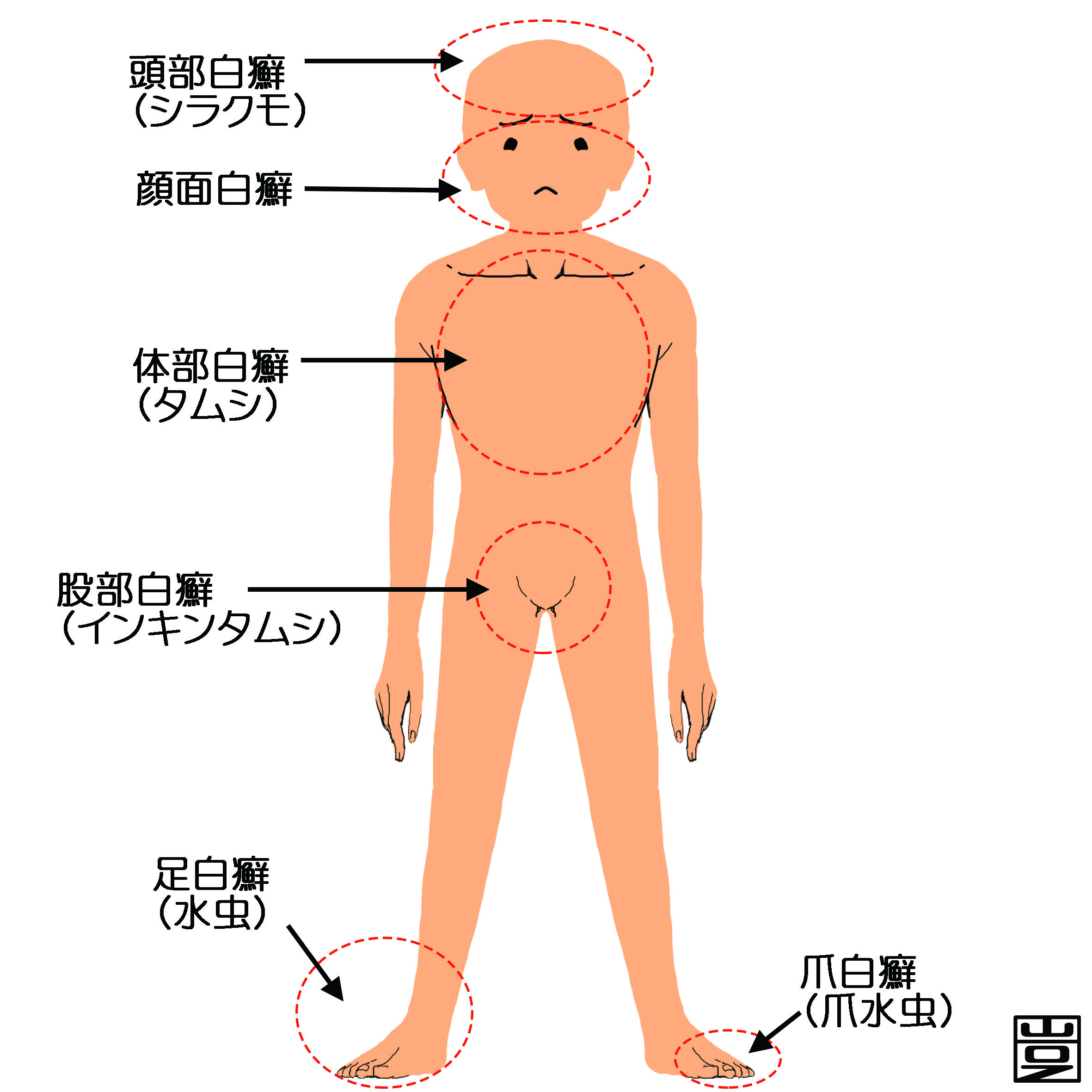 虫薬 爪 水