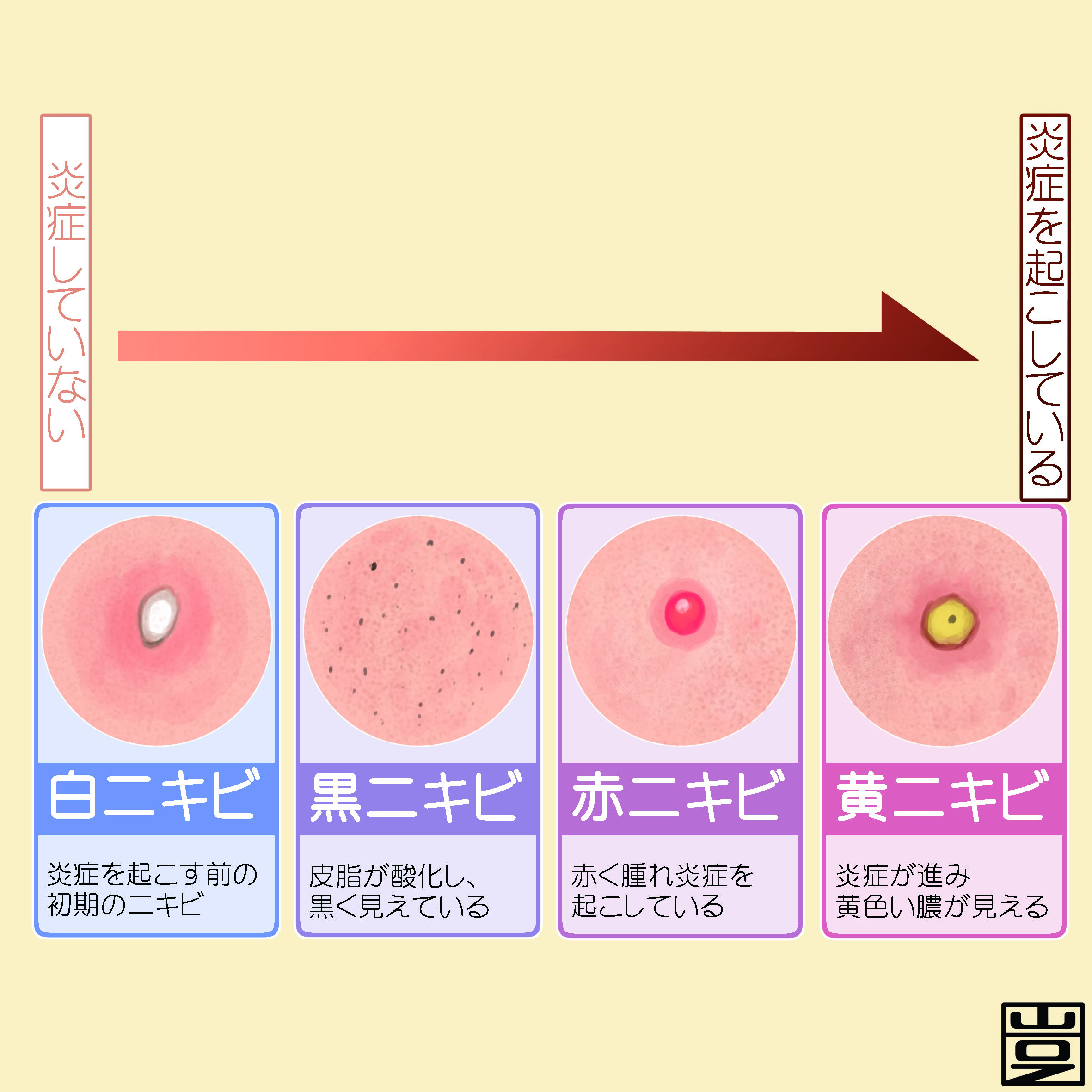 ニキビ 白い