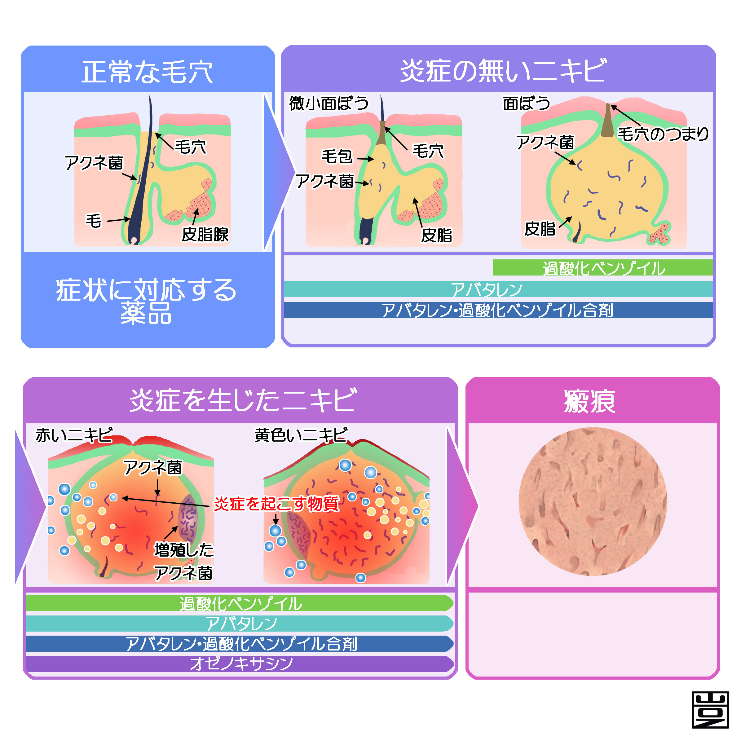 陰部 でき もの